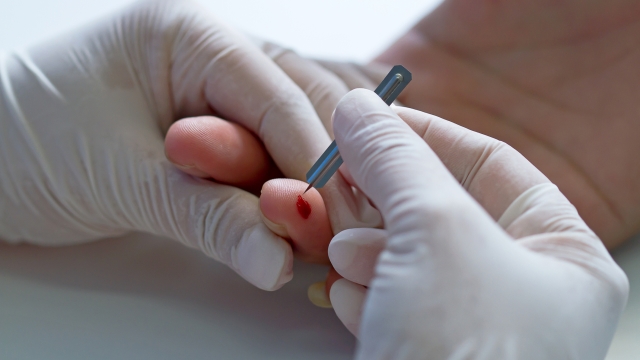 Hand of doctor and white glove show blood test by blood lancet
