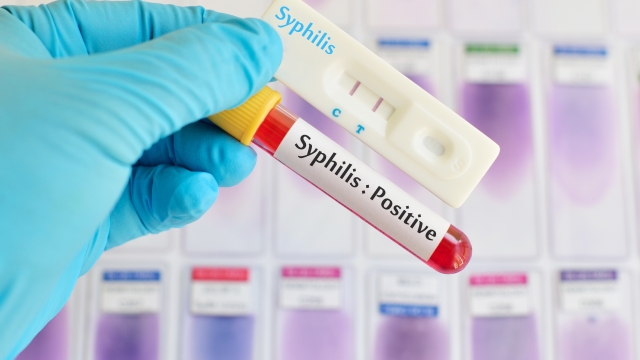 Syphilis testing positive by using cassette test