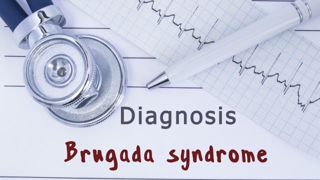 Diagnosis Brugada syndrome. Stethoscope or phonendoscope together with type of ECG lie on medical history with title diagnosis Brugada syndrome. Medical concept for cardiology and internal medicine