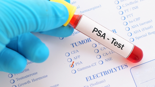 Blood sample for PSA test, diagnosis for prostate cancer