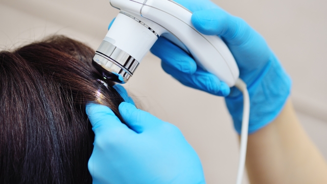 doctor cosmetologist dermatologist diagnoses the condition of the patient's hair using a trichoscope. Trichoscopy - computer examination of the scalp and hair