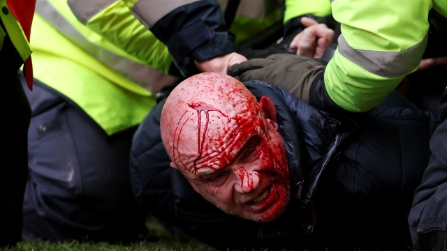 WEST BROMWICH, ENGLAND - JANUARY 28: (EDITORS NOTE: Image depicts graphic content.) A fan with a bloodied face is restrained by local police during the Emirates FA Cup Fourth Round match between West Bromwich Albion and Wolverhampton Wanderers at The Hawthorns on January 28, 2024 in West Bromwich, England. (Photo by Getty Images/Getty Images)