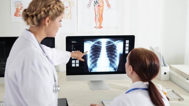 Pulmonologust and surgeon discussing chest x-ray of sick patient on computer screen
