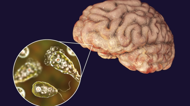 Ameba mangia-cervello acqua di rubinetto