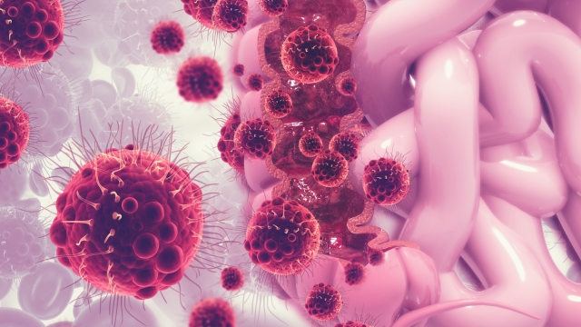 Prevenzione cancro al colon: quali test fare e a che età