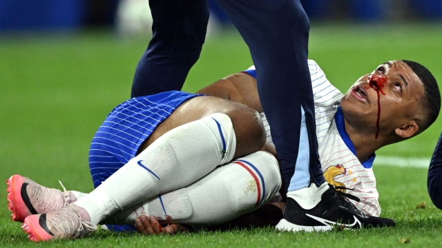 Kylian Mbappé, naso rotto contro l'Austria ad Euro 2024