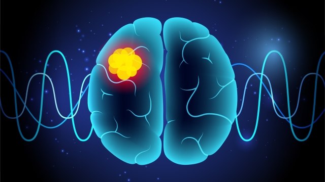 Glioma