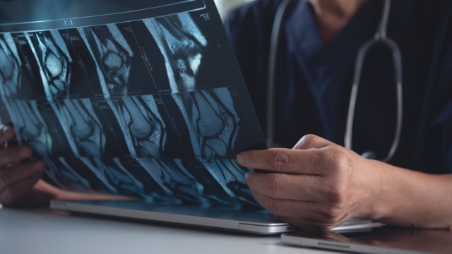 Doctor holding and looking patient bone x-ray film before surgery. MRI and CT scan examining at radiology orthopedic unit in hospital. Knee joint x-ray for treatment