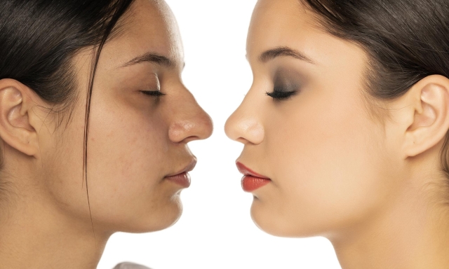 Comparison of female nose, before and after plastic surgery on a white background