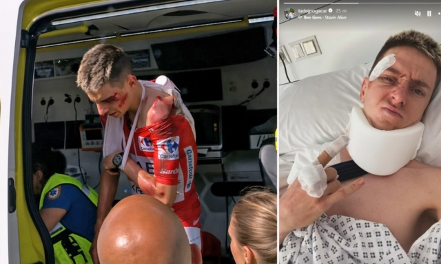 Pogacar e la caduta alla Vuelta: la diagnosi, l'intervento, quando può tornare. Tutti gli scenari