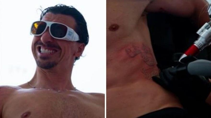 ibra che dolore zlatan rimuove un tattoo sulle costole