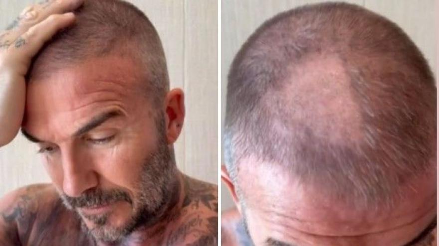 Beckham, che guaio! E Victoria lo prende in giro... Beckham, che guaio! E Victoria lo prende in giro...