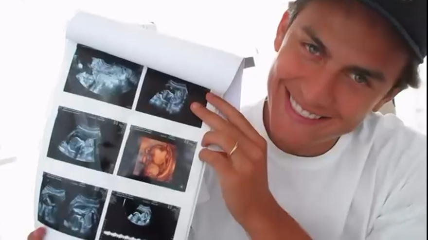 Sorriso Dybala, diventerà papà! L
