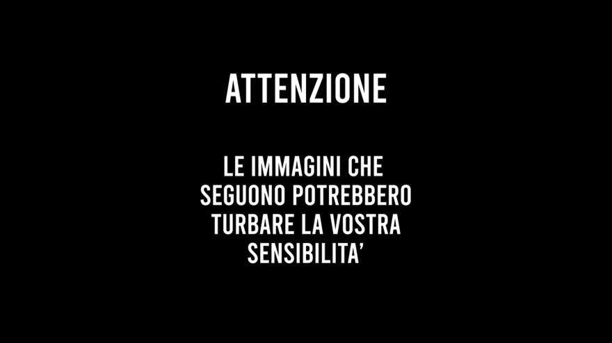 Infortunio shock in Senegal: gamba rotta e...