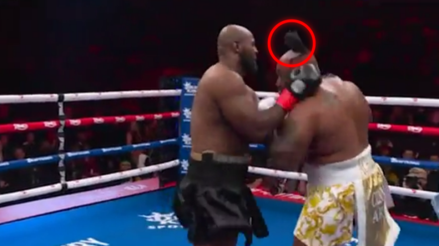 Jarrell Miller perde il parrucchino sul ring: "Ho lavato i capelli con l
