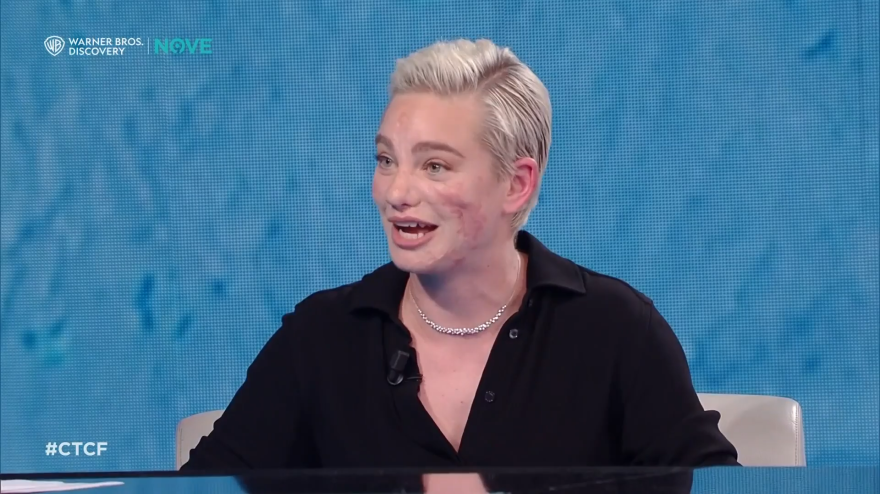 Bebe Vio, l Bebe Vio, l