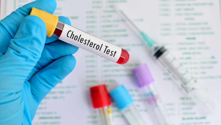 Blood sample for cholesterol testing