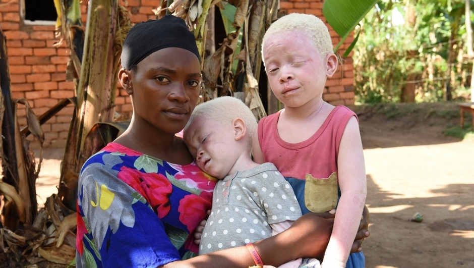 Before intervention:  A portrait of Aisha, Akram and Faith their mother seated at home.    Aisha (4 years) is a child with low vision and strong challenges in daily life due to albinism. Even her brother Akram (2,5 years) is facing the same condition and challenges. Both are clients of CBM partner Mengo Hospital. Please refer to the related story for more information.
