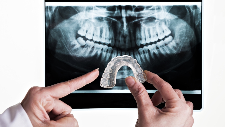 Malocclusione dentale e postura legame