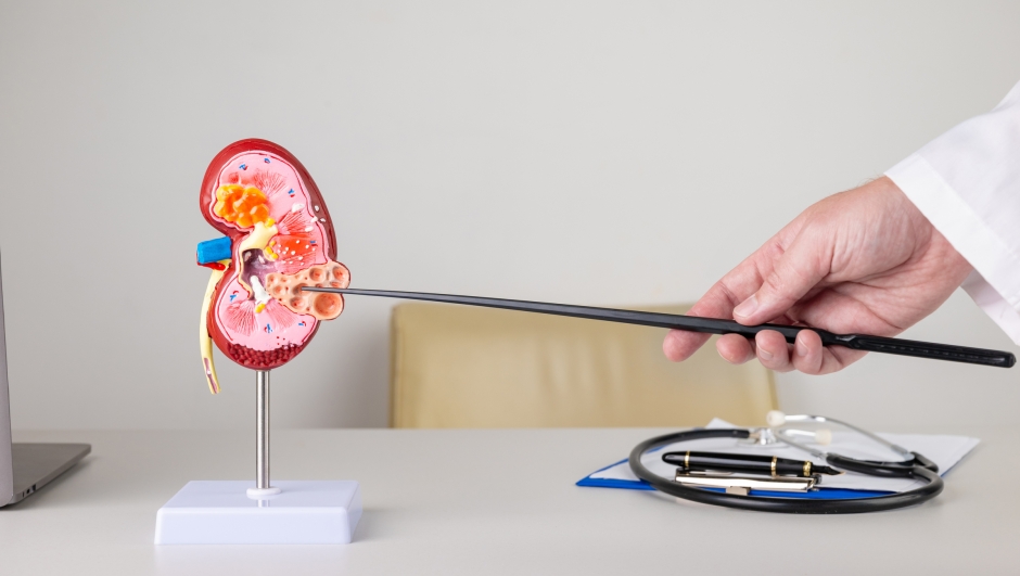 doctor nephrologist pointing at polycystic on a kidney mockup on his desktop