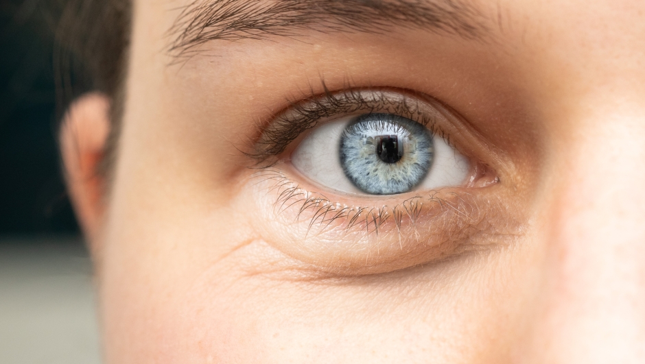 A closeup view on the blue eye of a beautiful young Caucasian woman showing wrinles and eye bags
