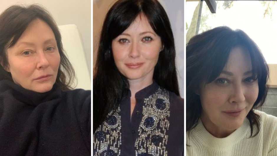 Shannen Doherty il tumore alle ossa