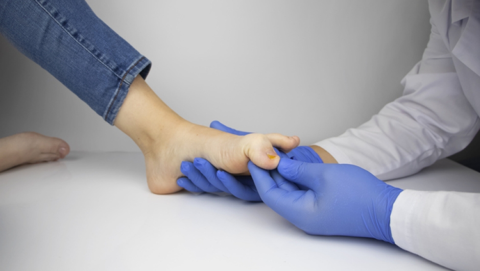 A dermatologist examines a toenail affected by a fungus. Treatment of mycosis and assistance to patients with fungal diseases.