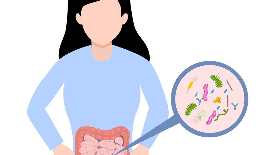 Small intestinal bacterial overgrowth (SIBO) is defined as the presence of excessive bacteria in the small intestine. SIBO is frequently implicated as the cause of chronic diarrhea and malabsorption.