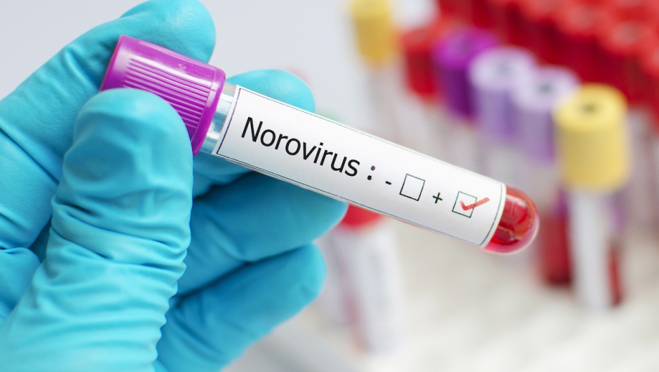 Norovirus cosa è