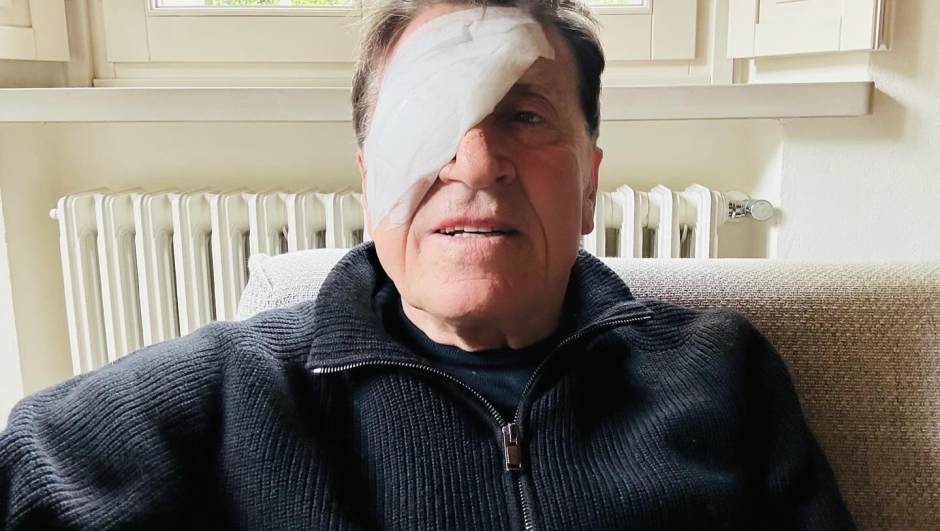 Con una foto pubblicata sui social, Gianni Morandi è comparso con una benda sugli occhi. "Ho fatto a pugni", scrive. Ecco cos'è successo realmente.