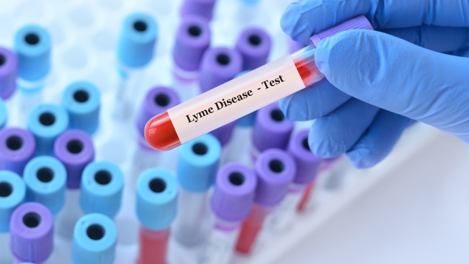Malattia di Lyme vaccino a che punto siamo