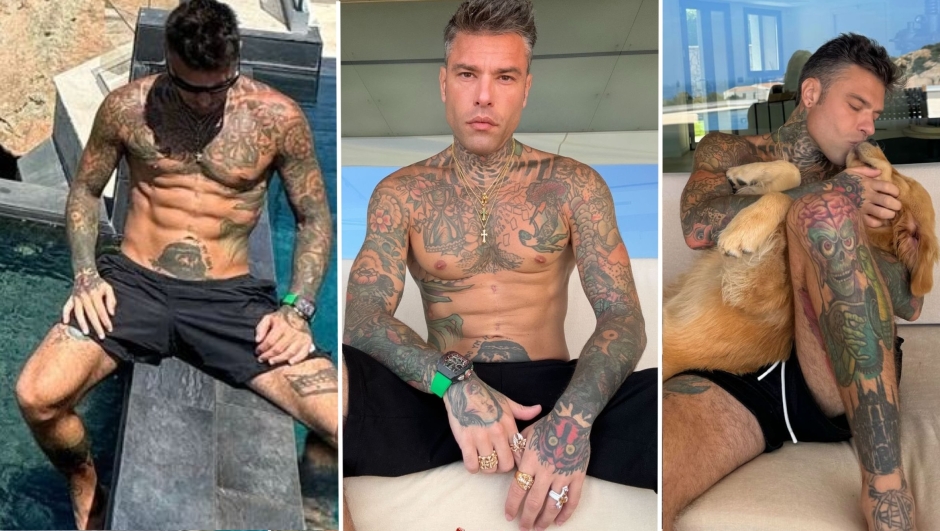 Fedez sta meglio dopo il ricovero, ma i medici lo mettono in guardia