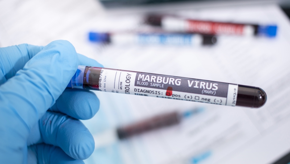 Virus di Marburg