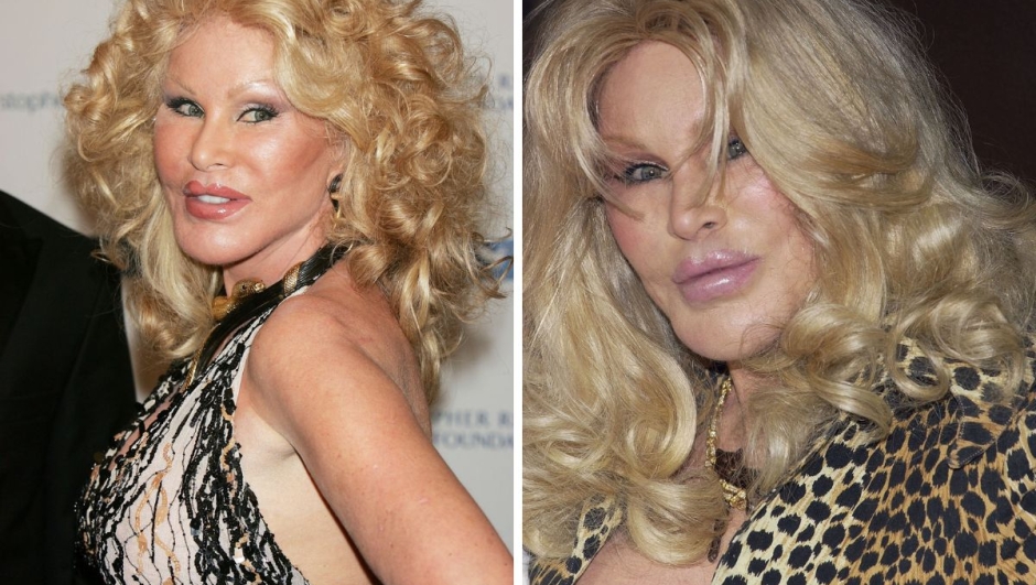 Morta Jocelyn Wildenstein la donna gatto