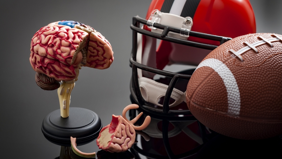 Brain damage and sports injury concept with damaged brain model, american football helmet and a ball, illustrating CTE (Chronic traumatic encephalopathy) a syndrome caused by repeated concussion