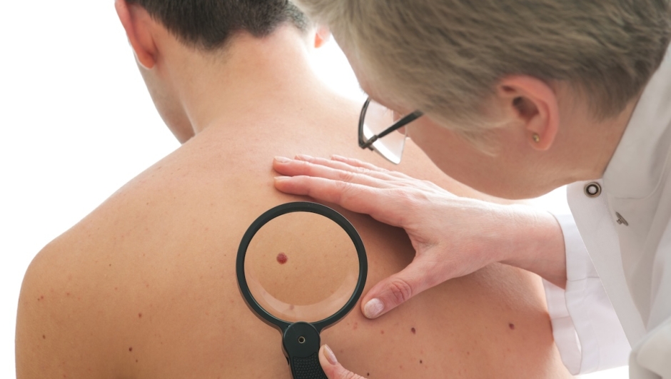 Dermatologist examines a mole of male patient