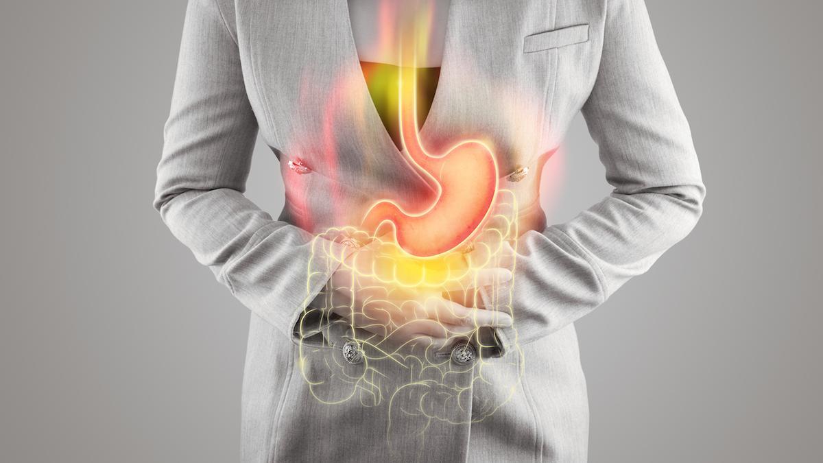 Il reflusso gastroesofageo peggiora con il caldo: 10 regole d Il reflusso gastroesofageo peggiora con il caldo: 10 regole d