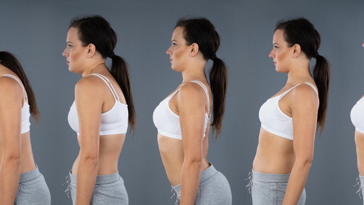 Pancia sporgente? Non è detto che sia "ciccia", ma postura iperlordotica. Ecco come rimediare