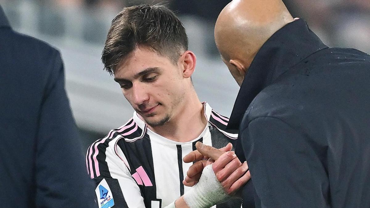 Sollievo Juve: nessuna lesione per Conceiçao e McKennie. Ma si ferma Rugani