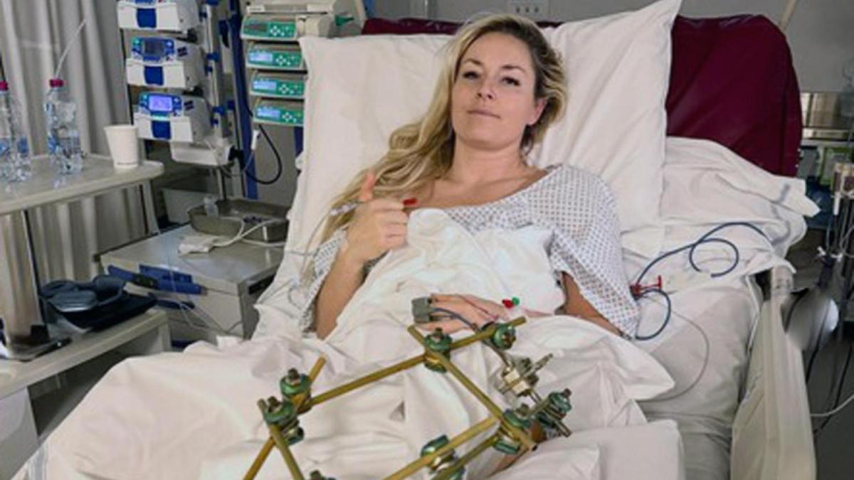 vonn dimessa non siate tristi torner242 e scier242 sempre rischiando ma dando tutta me stessa