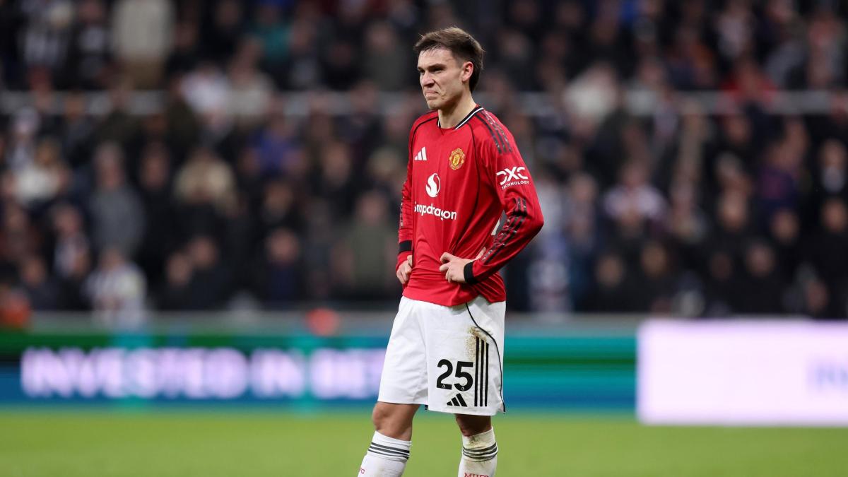 Un mediano nato attaccante che guarda avanti. Anche col trapianto di capelli: Juve, ecco Ugarte