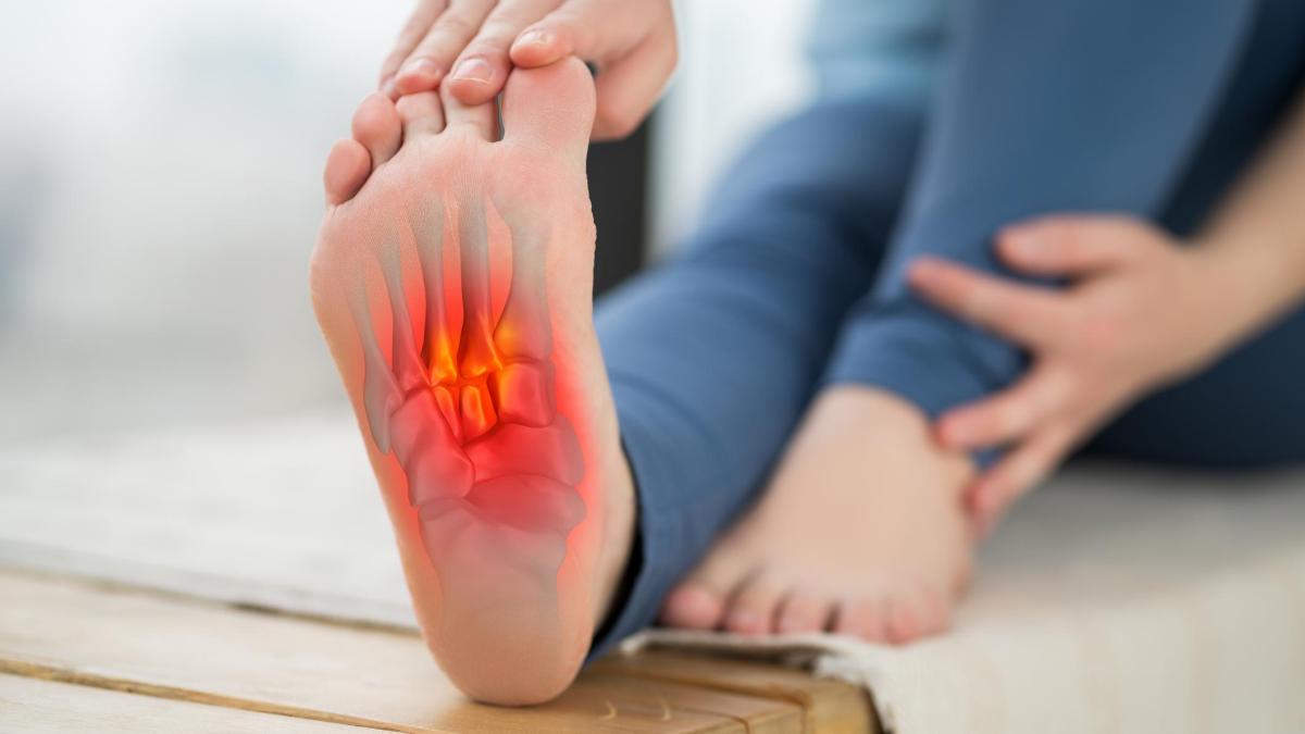 Fascite plantare: una nuova cura può aiutare a guarire quand