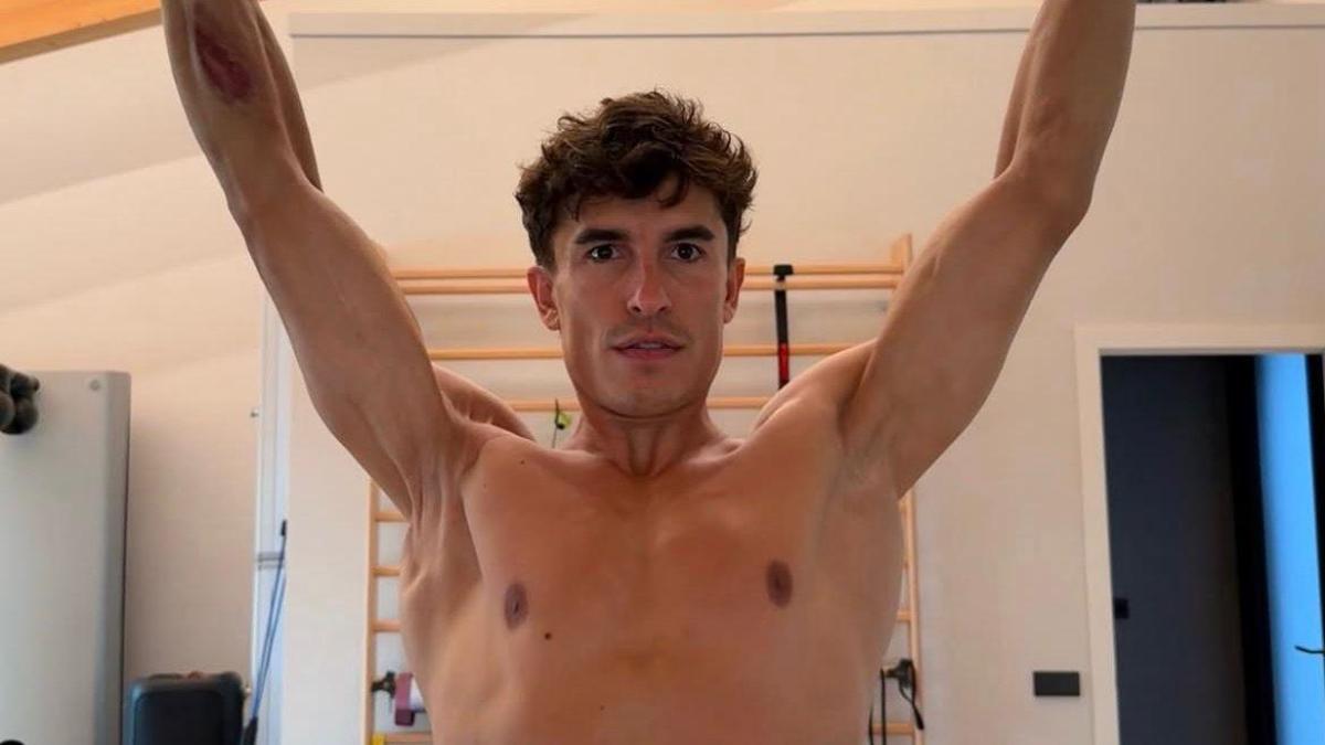 marc marquez e la foto shock della spalla dopo 7 operazioni ma come fa a gareggiare da Gazzetta.it marc marquez e la foto shock della spalla dopo 7 operazioni ma come fa a gareggiare