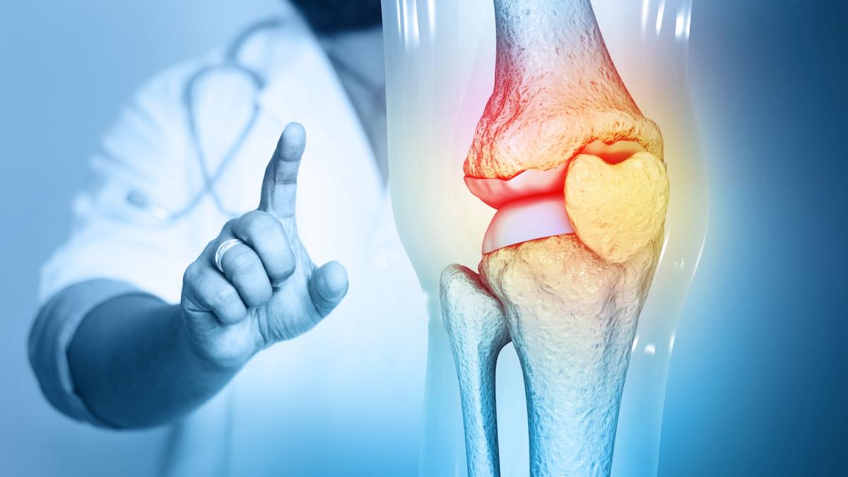 Ipercalcemia: cause, sintomi e rimedi quando i livelli di calcio sono troppo alti