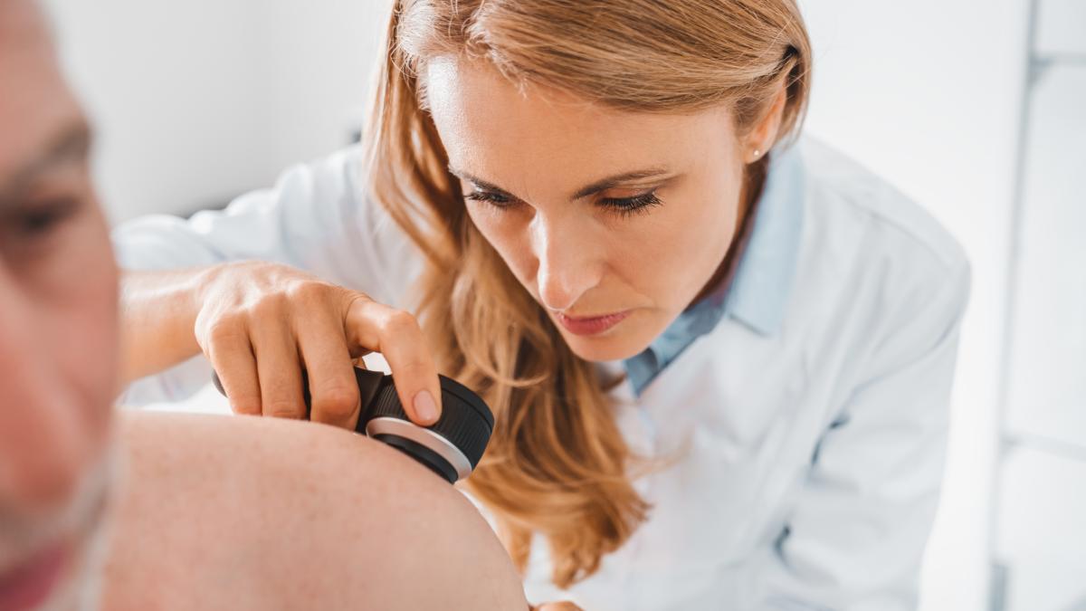 Basalioma: come riconoscere questo diffuso tumore della pelle