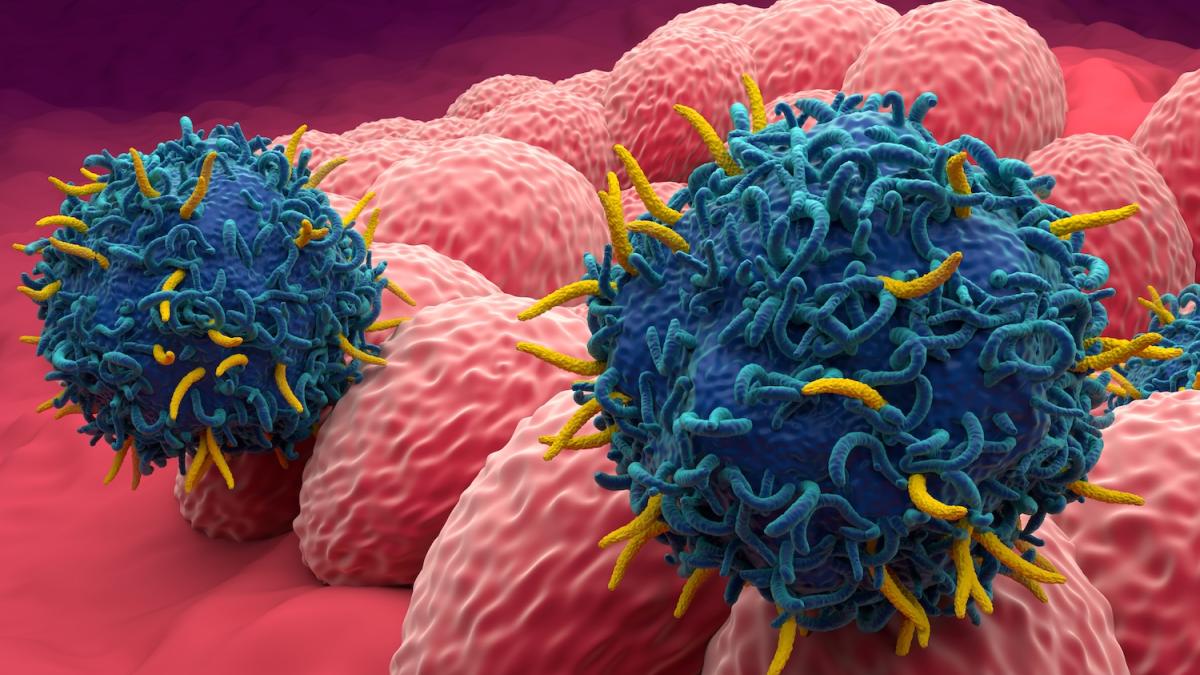 aggressivit224 dei tumori il nuovo parametro per valutarla