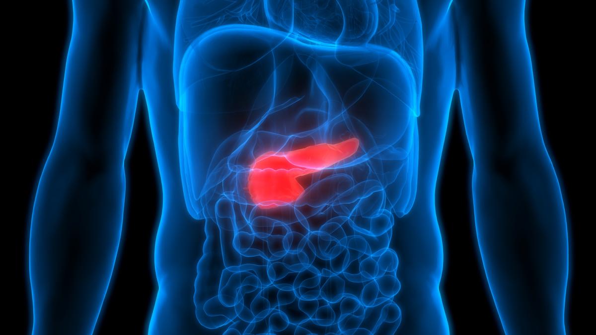 Tumore al pancreas: ecco come aumenta il rischio a causa di un Tumore al pancreas: ecco come aumenta il rischio a causa di un