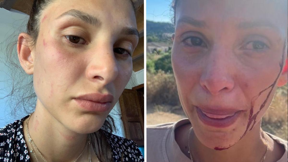 Sara Bluma denuncia le violenze dell Sara Bluma denuncia le violenze dell