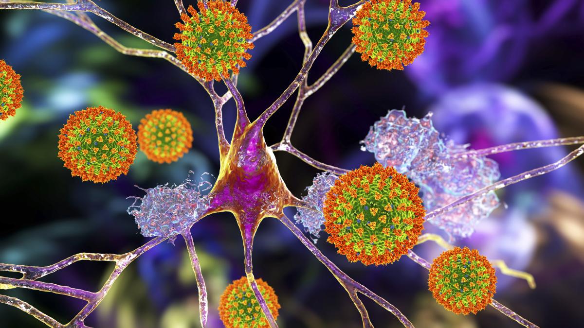 il lato oscuro del covid placche dell8217alzheimer anche negli occhi