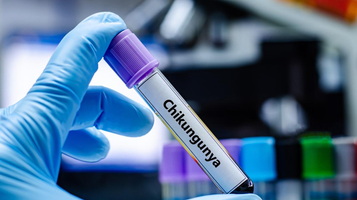 Vaccino Chikungunya, dal 30 ottobre in Italia si può fare il Vlp. Ecco come funziona Vaccino Chikungunya, dal 30 ottobre in Italia si può fare il Vlp. Ecco come funziona